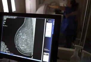 Raio X mamaria feminina